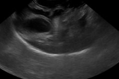 Figure 3: Recheck ultrasound of same dog as figure 2 one week later showing resolving masses.